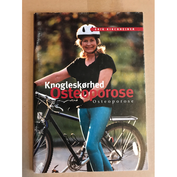 Knogleskrhed